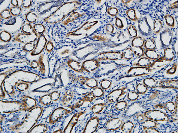 p15 Polyclonal Antibody