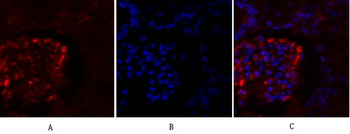 OPG Polyclonal Antibody