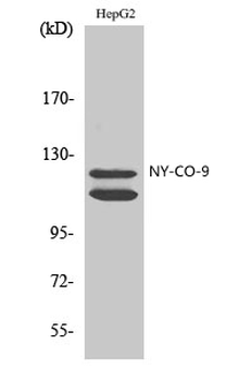 NY-CO-9 Polyclonal Antibody