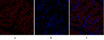 NOS2 Polyclonal Antibody