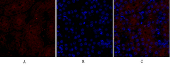 NOS2 Polyclonal Antibody