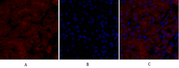 NOS2 Polyclonal Antibody
