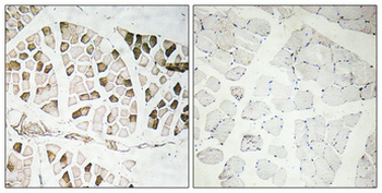 Nogo A Polyclonal Antibody