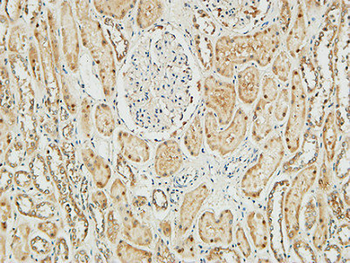 NM23-H1 Polyclonal Antibody