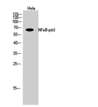 NFκB-p65 Polyclonal Antibody