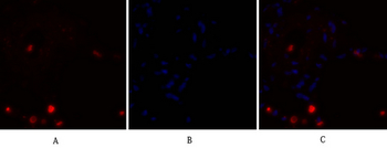 NFκB-p105/p50 Polyclonal Antibody