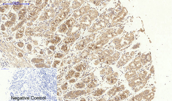 NFκB-p105/p50 Polyclonal Antibody