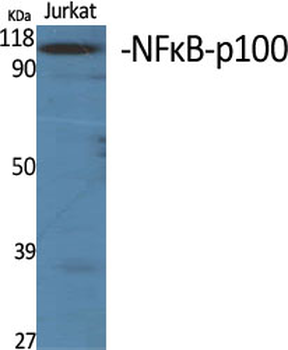 NFκB-p100 Polyclonal Antibody