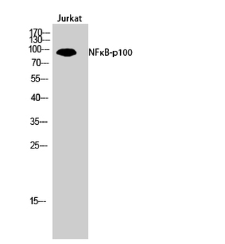 NFκB-p100 Polyclonal Antibody