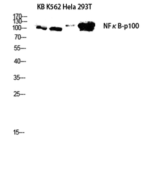 NFκB-p100 Polyclonal Antibody