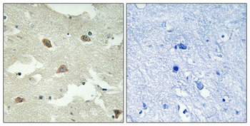 NEEP21 Polyclonal Antibody