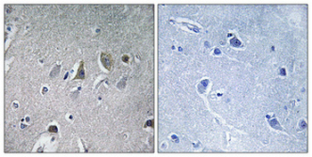 NDUFV2 Polyclonal Antibody