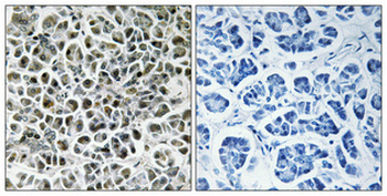 NDUFA3 Polyclonal Antibody