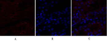 N-cadherin Polyclonal Antibody