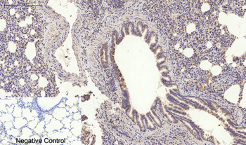 MyD88 Polyclonal Antibody