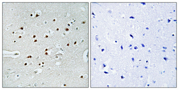 MRTF-A Polyclonal Antibody