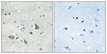 MRP-L32 Polyclonal Antibody