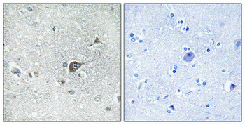 MRP-L20 Polyclonal Antibody