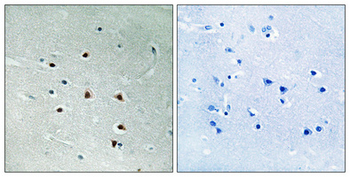 MRE11 Polyclonal Antibody