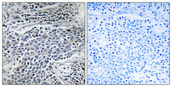 MMP-11 Polyclonal Antibody
