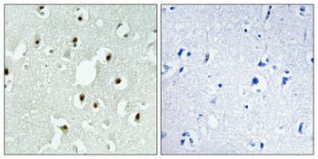 MLH3 Polyclonal Antibody