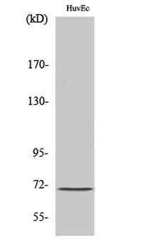 Menin Polyclonal Antibody