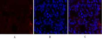 MEK-1/2 Polyclonal Antibody