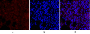 MEK-1/2 Polyclonal Antibody