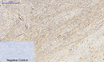 MEK-1/2 Polyclonal Antibody