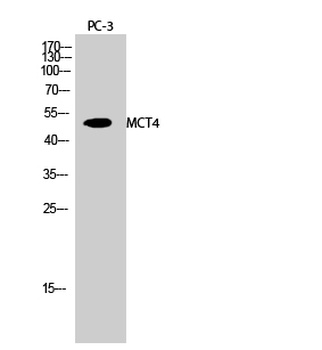 MCT4 Polyclonal Antibody