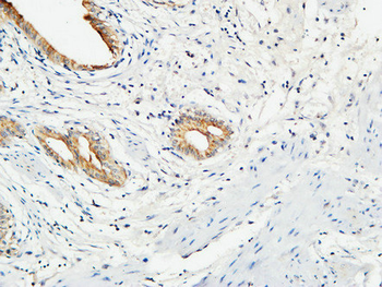 MMP-7 Polyclonal Antibody