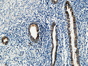 MMP-7 Polyclonal Antibody