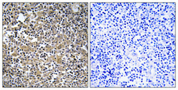 MAST205 Polyclonal Antibody