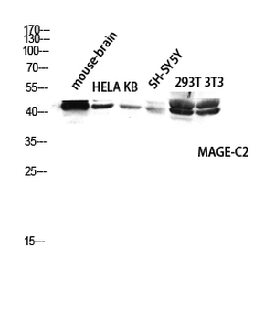 MAGE-C2 Polyclonal Antibody