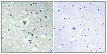 LDOC1L Polyclonal Antibody