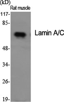 Lamin A/C Polyclonal Antibody