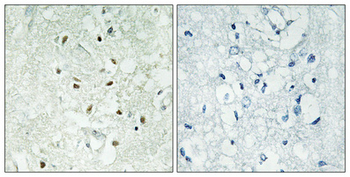 Ku-86 Polyclonal Antibody