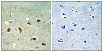 KKIALRE Polyclonal Antibody