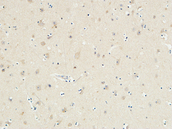 KiSS-1R Polyclonal Antibody