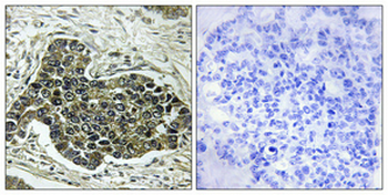 KIF20A Polyclonal Antibody