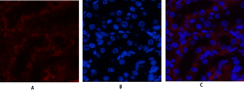 JAK3 Polyclonal Antibody
