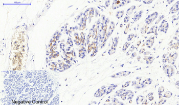 JAK3 Polyclonal Antibody
