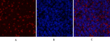 JAK2 Polyclonal Antibody