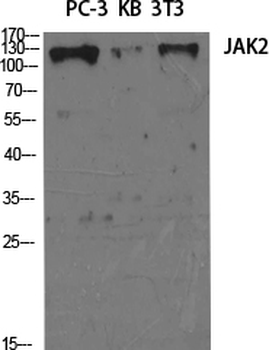 JAK2 Polyclonal Antibody