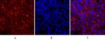 JAK1 Polyclonal Antibody