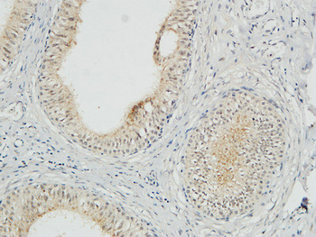JAB1 Polyclonal Antibody