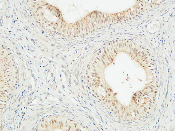 JAB1 Polyclonal Antibody