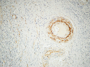 ILK Polyclonal Antibody
