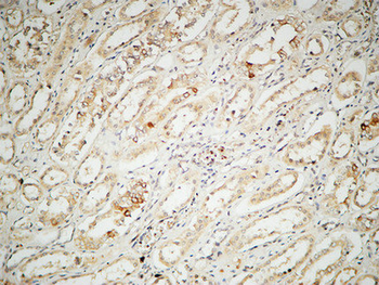 IL-2 Polyclonal Antibody