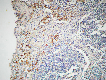 IL-12A Polyclonal Antibody